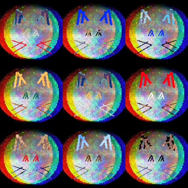 An image of "Skunquarks"